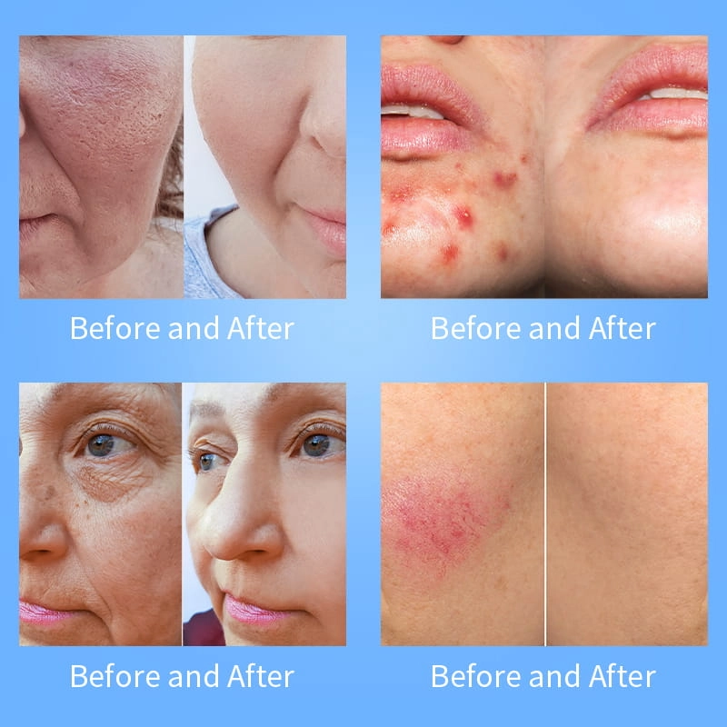 14 IN 1Magnetic Face Machine (10) - HUIMAIN