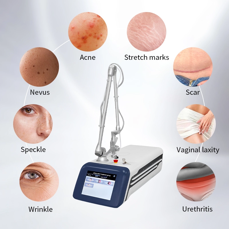 CO2 fractional laser for treating acne, scars, stretch marks, wrinkles, and vaginal laxity. - HUIMAIN