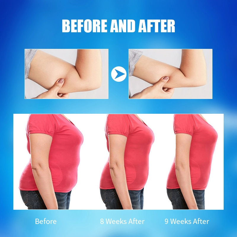 360 cryolipolysis machine - HUIMAIN