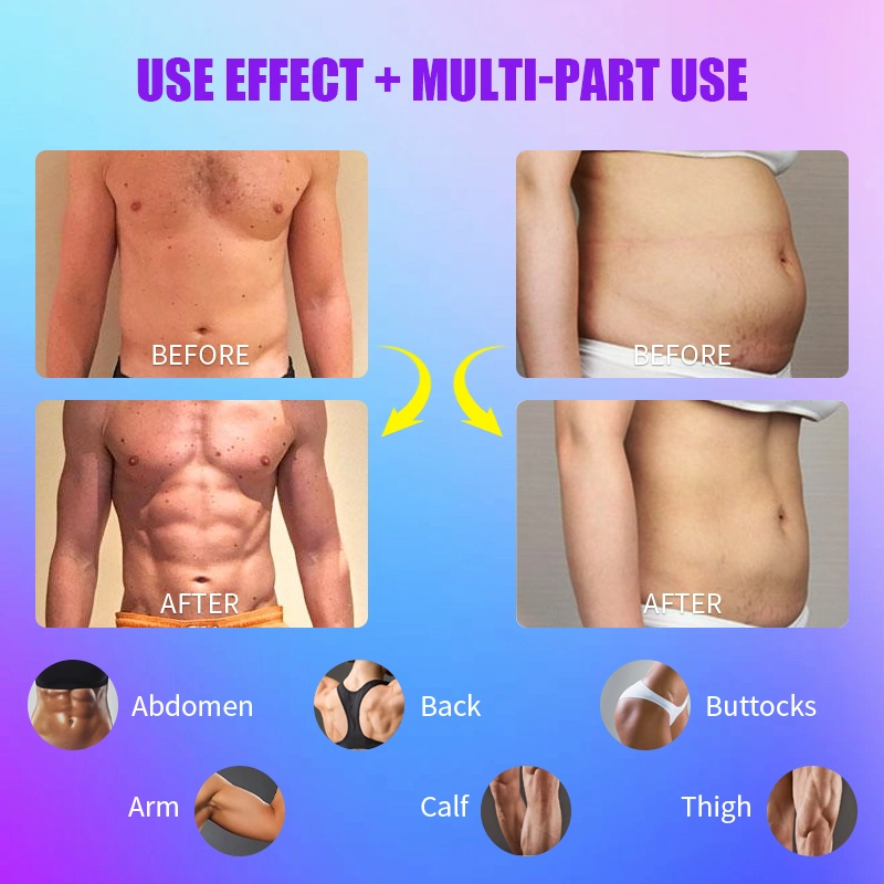 Best-body-sculpting-Machine - HUIMAIN Best body sculpting Machine - HUIMAIN