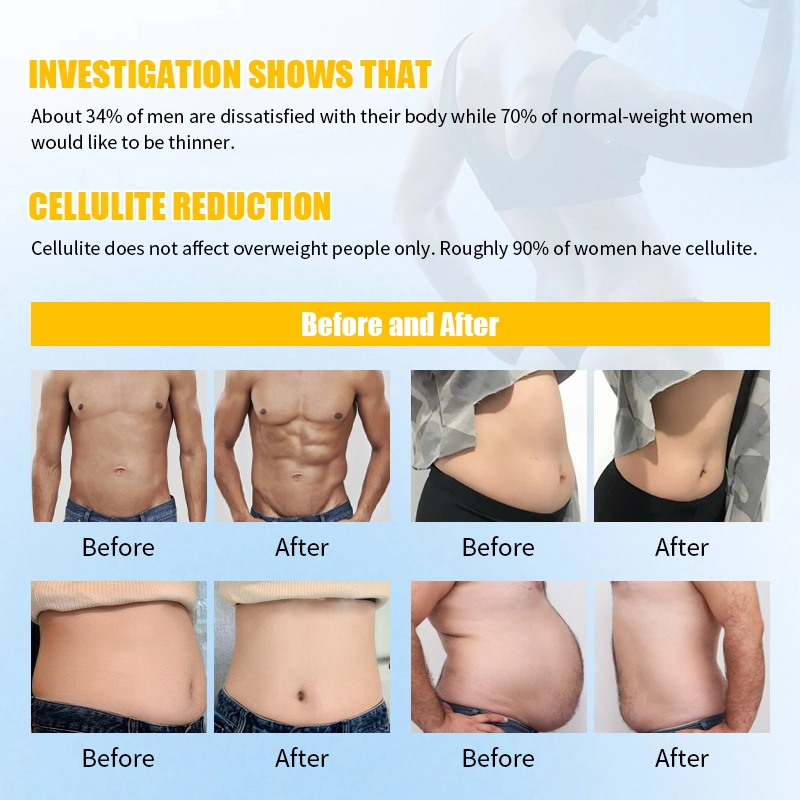 Portable-EMS-slimming-machine-with-RF-heating-technology - HUIMAIN Portable EMS slimming machine with RF heating technology - HUIMAIN