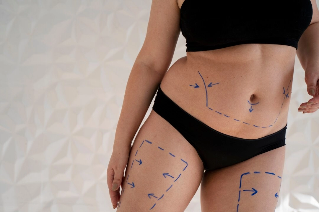 Body-Contouring-&-Firming - HUIMAIN Body Contouring & Firming - HUIMAIN