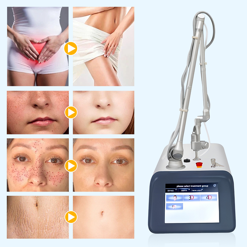 Clinical Fractional CO2 Laser Device for skin texture improvement