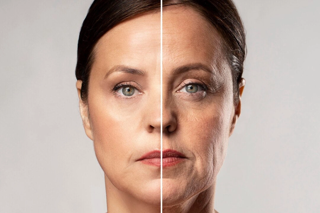 Facial Lifting & Wrinkle Reduction - HUIMAIN
