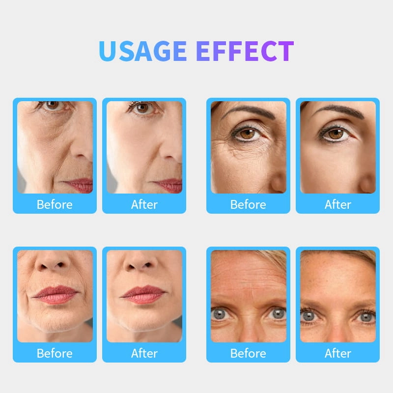 Facial Lifting2 (8) - HUIMAIN