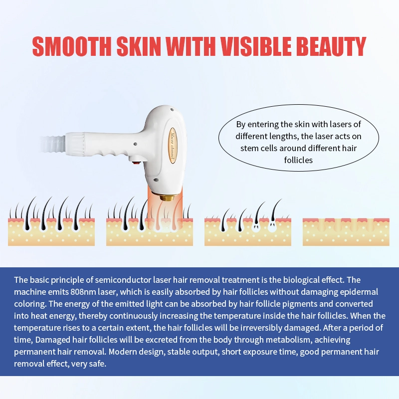 High-performance diode laser hair removal machine for salon and clinic use - HUIMAIN