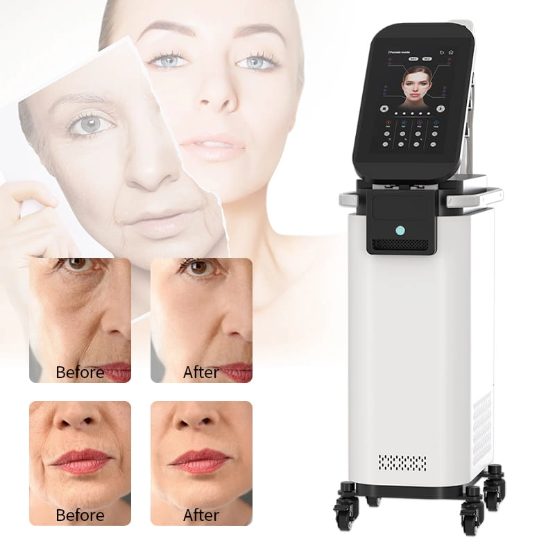 Magnetic Facial Lifting Machine2 (12) - HUIMAIN