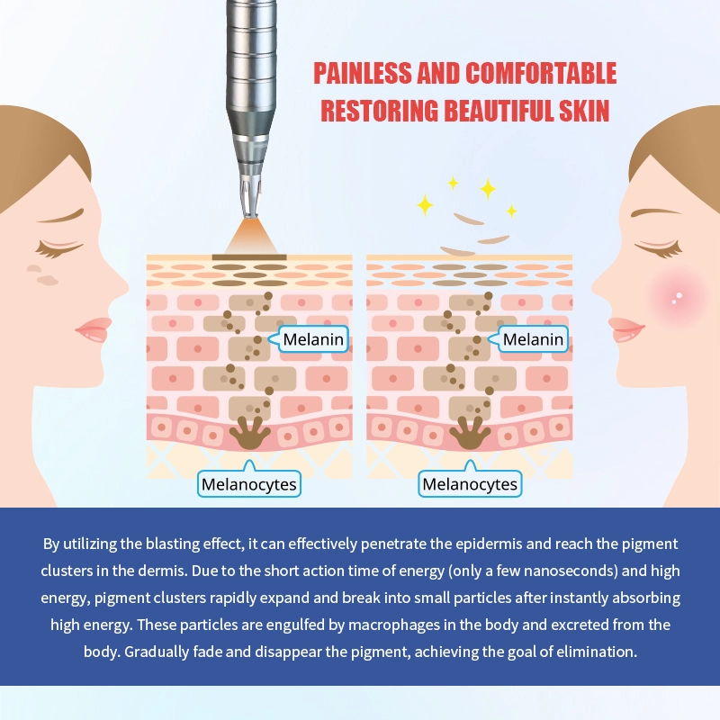 Picosecond laser machine for pigmentation removal, acne scars, and skin brightening - HUIMAIN
